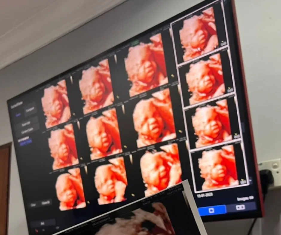 klinik nur medicare scan 3D 4D 5D