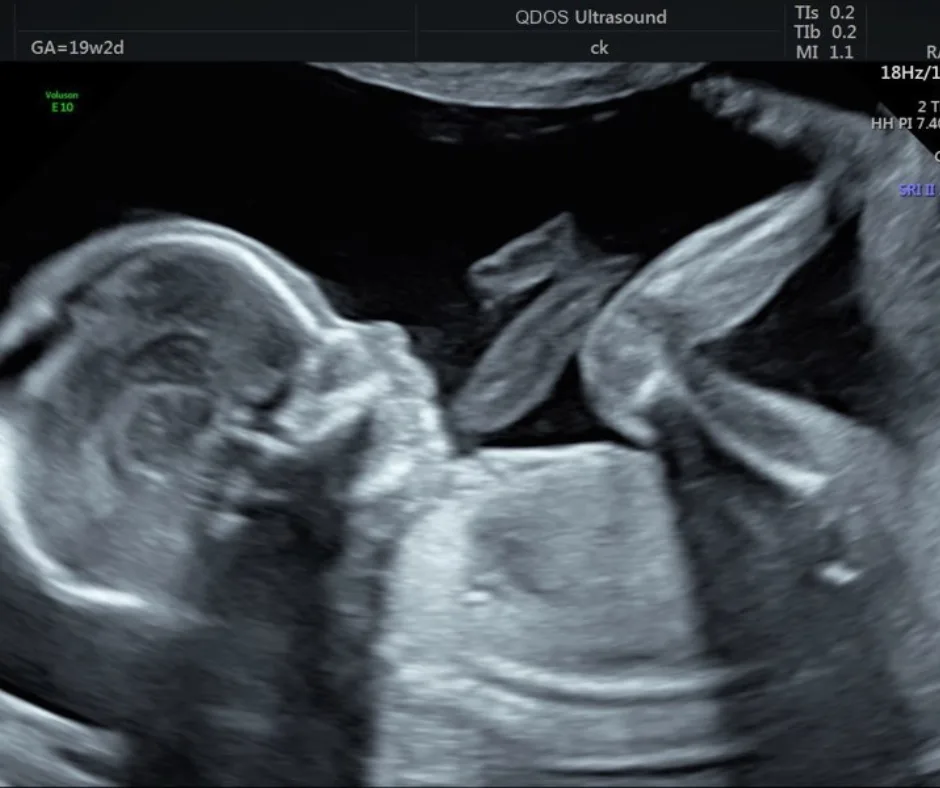 klinik nur medicare anatomy scan