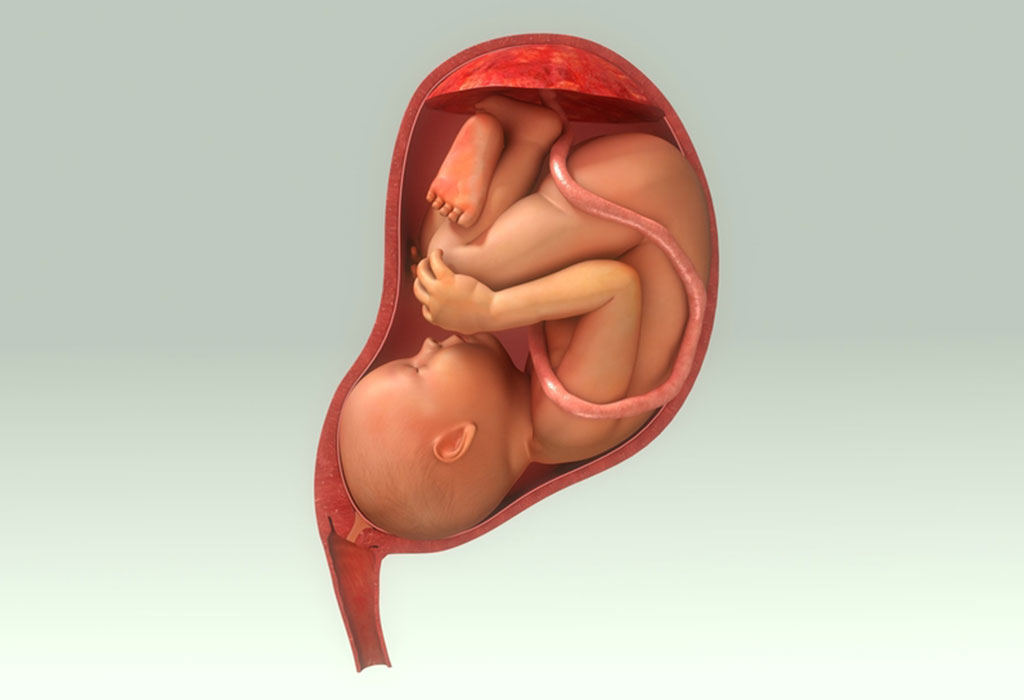 placenta bayi tak bergerak