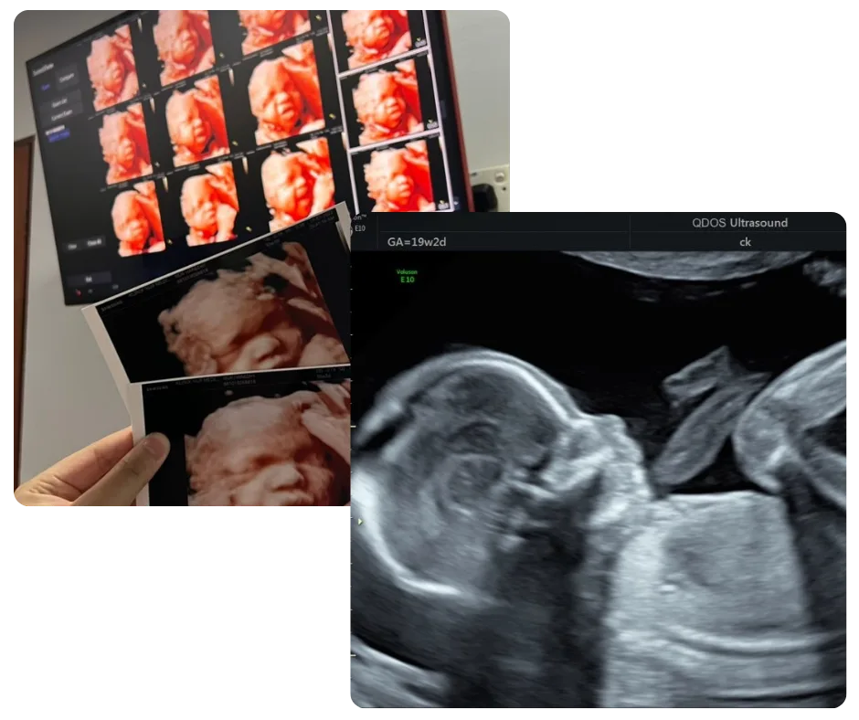 klinik nur medicare combo scan